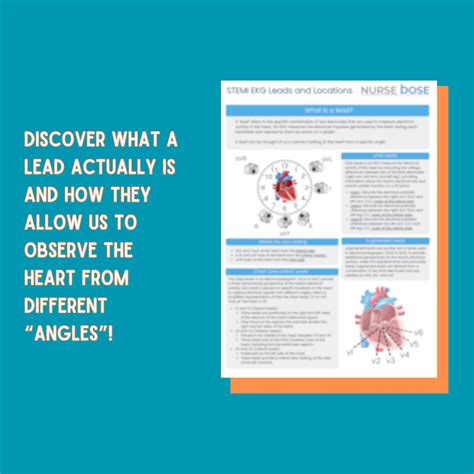 Cardiac Nursing Notes - STEMI Leads & CCRN Study Guide - CVICU Cheat ...