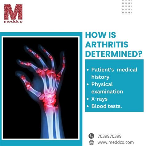 Arthritis Disease - Can Arthritis Kill You? - Part 2