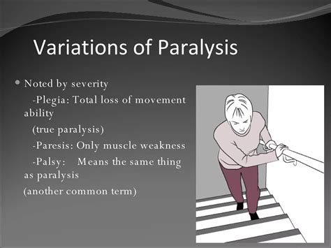 Paralysis | PPT