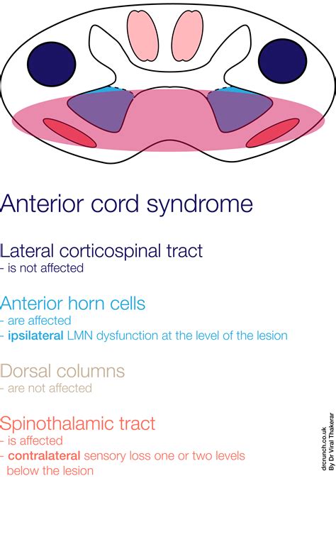 Getting tied up with the spinal cord – Dr Crunch Blog