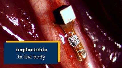 Image result for Neural Dust