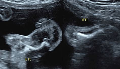 孕23周：宝宝和孕妈妈的新变化，又有小惊喜！ - 知乎