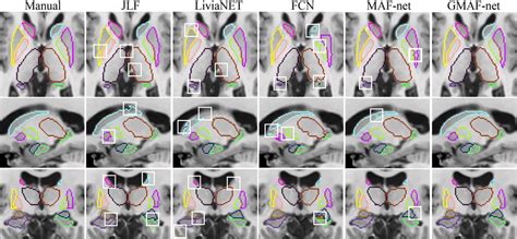 Segmentation Visualization Stack Overflow 的图像结果