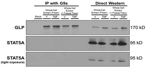 TNFα Effects on Adipocytes Are Influenced by the Presence of Lysine ...