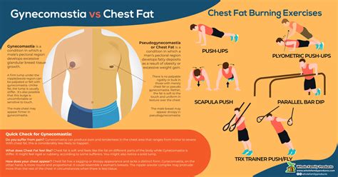 Symptoms Of Gynecomastia