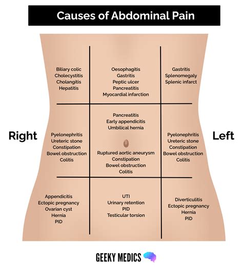 Abdominal Pain History Taking - OSCE Guide | Geeky Medics
