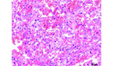 Image result for Hemangiosarcoma