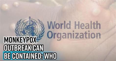 US reports 25,341 monkeypox cases - IBTimes India