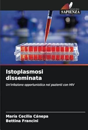 Buy Istoplasmosi disseminata Book Online at Low Prices in India ...