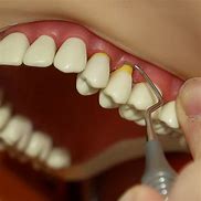 Image result for dentine