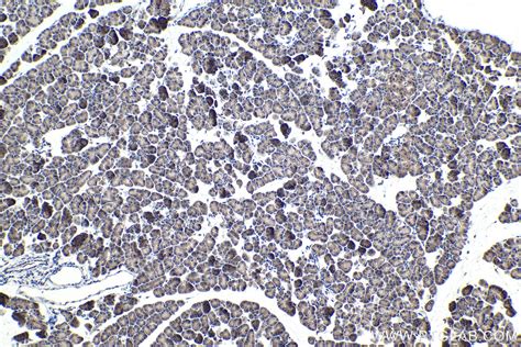 IHCeasy SMAD4 Ready-To-Use IHC Kit KHC1713 | Proteintech
