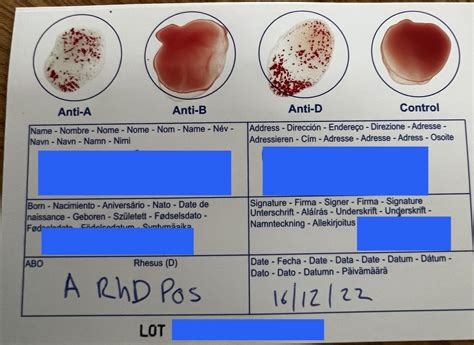 DIY blood type testing kit results card I was sent by the NHS : r ...
