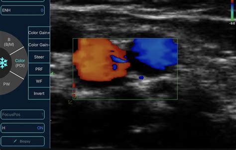 Is Ultrasound Better Than X-Ray? Understanding the Differences and When Each Matters - Portable ...