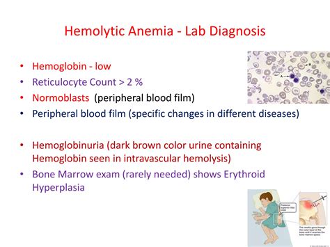Hemolytic anemia in children 2021 | PDF