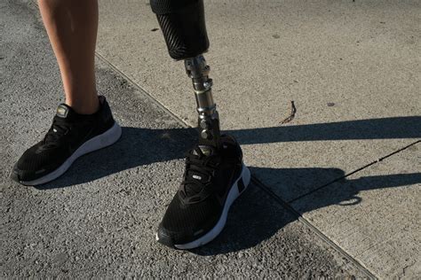 Prosthetic Feet - ALPS South