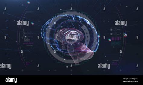 Image result for Human Brain Scan