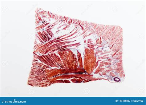 Image result for Skeletal Muscle Tissue Under Microscope