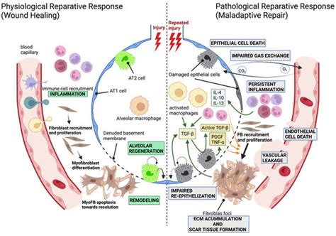 Cells | Topical Collection : Pulmonary Fibrosis and Cell Therapy