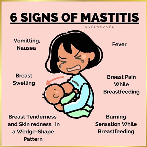 Best 13 Mastitis: Causes, Symptoms, Treatment, and How to Prevent It ...