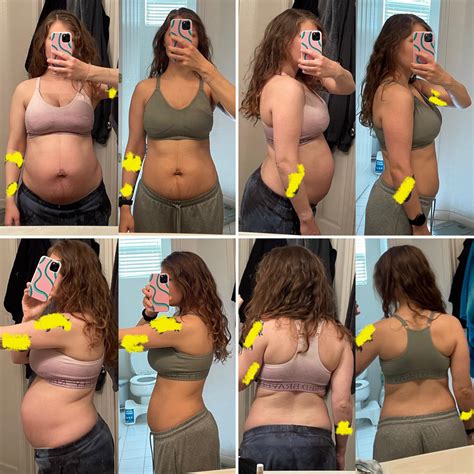 Postpartum Weight Gain