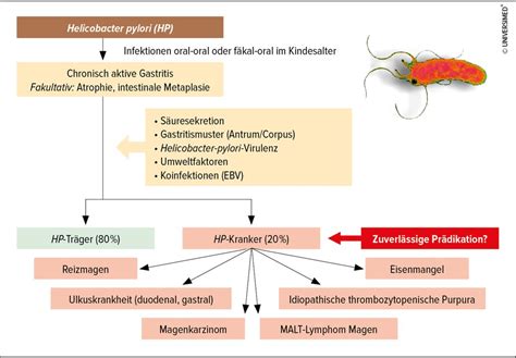 Helicobacter pylori: Was bleibt, was ändert sich? - Gastroenterologie ...