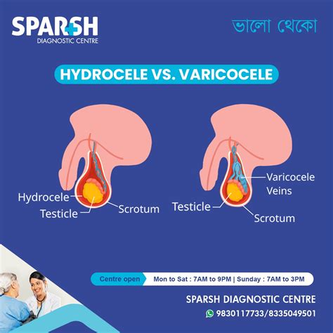 Hydrocele vs Varicocele - Sparsh Diagnostic Center