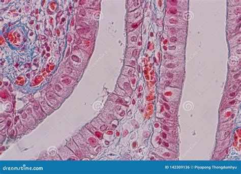 Simple Columnar Epithelium Slide Labeled