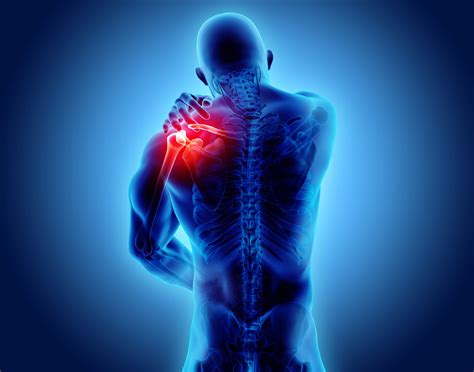3 Most Common Shoulder Pain Causes and Treatments - iPHYSIO Blog