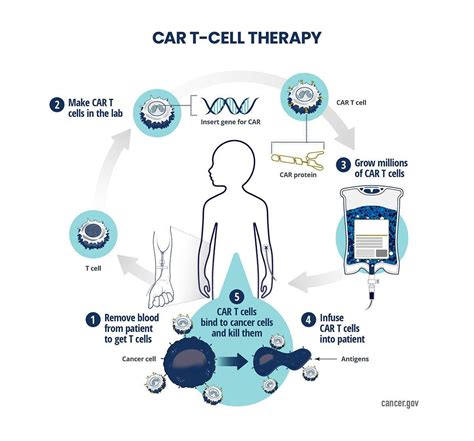 Car T Process Graphic