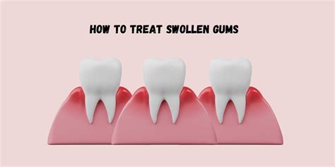 How to Treat Swollen Gums - PUREXA Oral Care