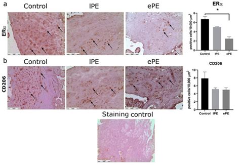 Expression of Estrogen Receptor α by Decidual Macrophages in Preeclampsia