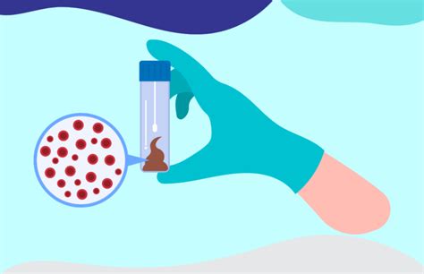 Image result for Fit Stool Test