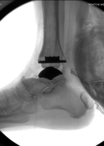 Hardware Monitor Driver 的图像结果