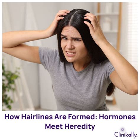 Reading Your Roots: What Hairline Shape Reveals | Clinikally