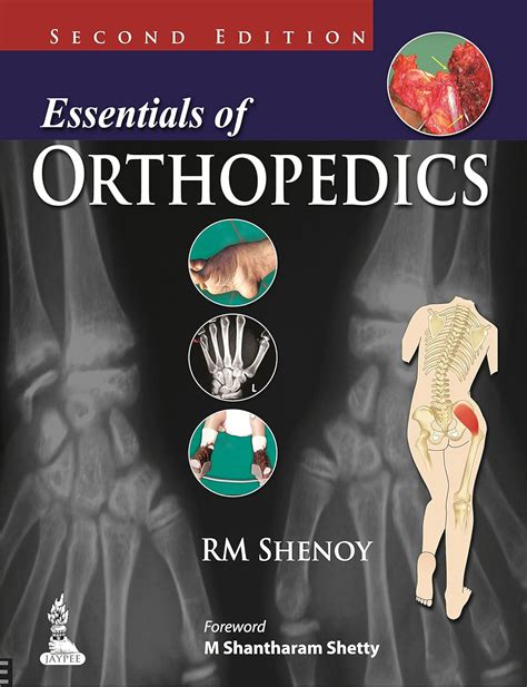 Buy Essentials Of Orthopedics Book Online at Low Prices in India ...