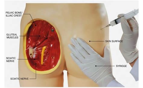 AjantaExports Intramuscular injection training Adult injection manikin ...