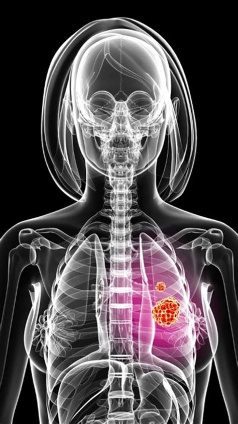 फिटनेस | Visual Stories In Hindi – NDTV India