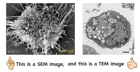 SEM Vs TEM