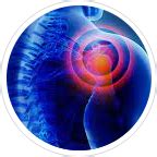 Cupping Therapy Center Delhi, NCR | Doctors for Cupping therapy | APRC