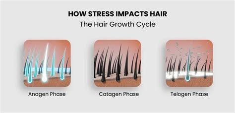 How Does Stress Stimulate Hair Fall & Hair Thinning? – Fixderma Skincare
