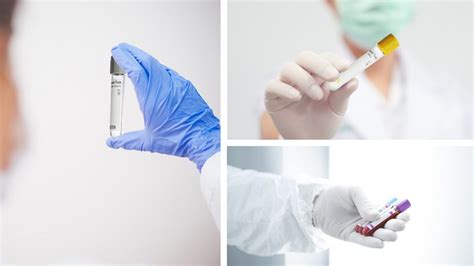 Image result for Test-Tube Sample