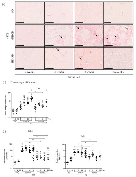 Hepatocellular Carcinoma Emergence in Diabetic Mice with Non-Alcoholic ...