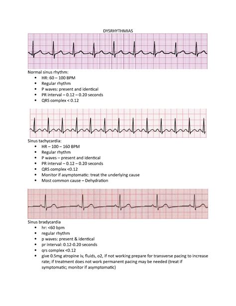 Dysrhythmia Strips
