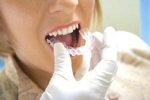 I Got Braces at 60 Years Old, and My Smile’s Never Looked Better HD Wallpaper