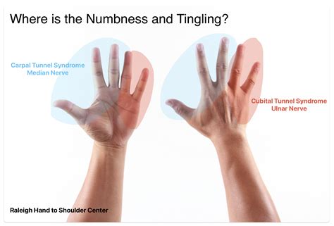 Hand and Wrist Symptom Checker - John Erickson, MD