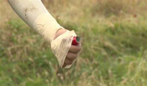 petarde povrede - Informer.rs