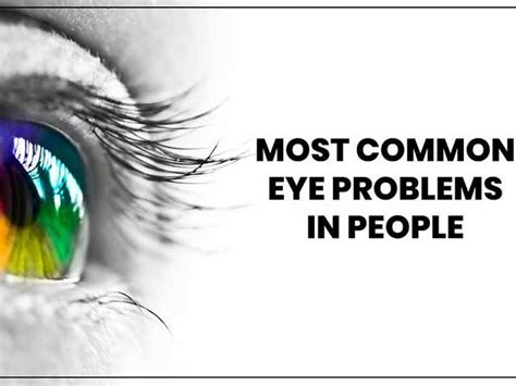 Image result for Common Eye Problems