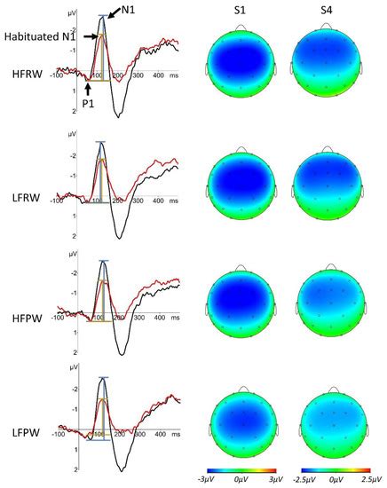 Short-Term Habituation of Auditory N1 in Spoken Word-Forms Is Modulated ...
