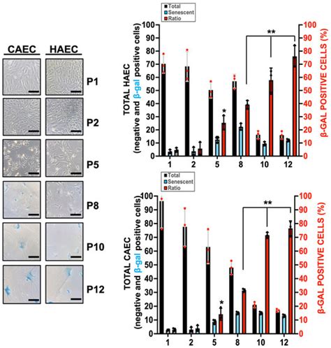 Replicative Endothelial Cell Senescence May Lead to Endothelial ...