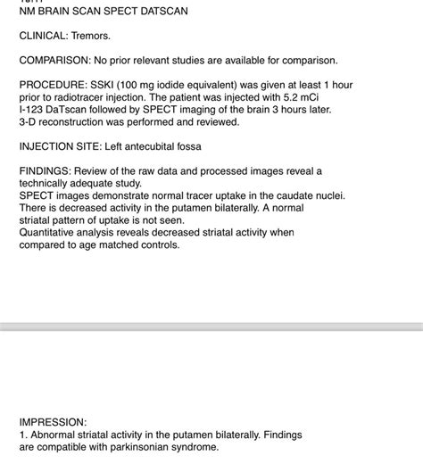 Datscan Today : r/Parkinsons